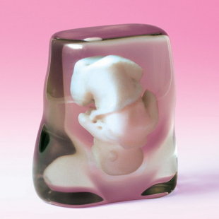 3D Model of fetus